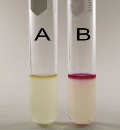 <p>What is the name of the test, purpose, the media, inoculation guide, incubation, theory, results, and everything about it?</p>