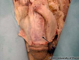 <p>what layer of the scrotum is being indicted to in the image?</p>