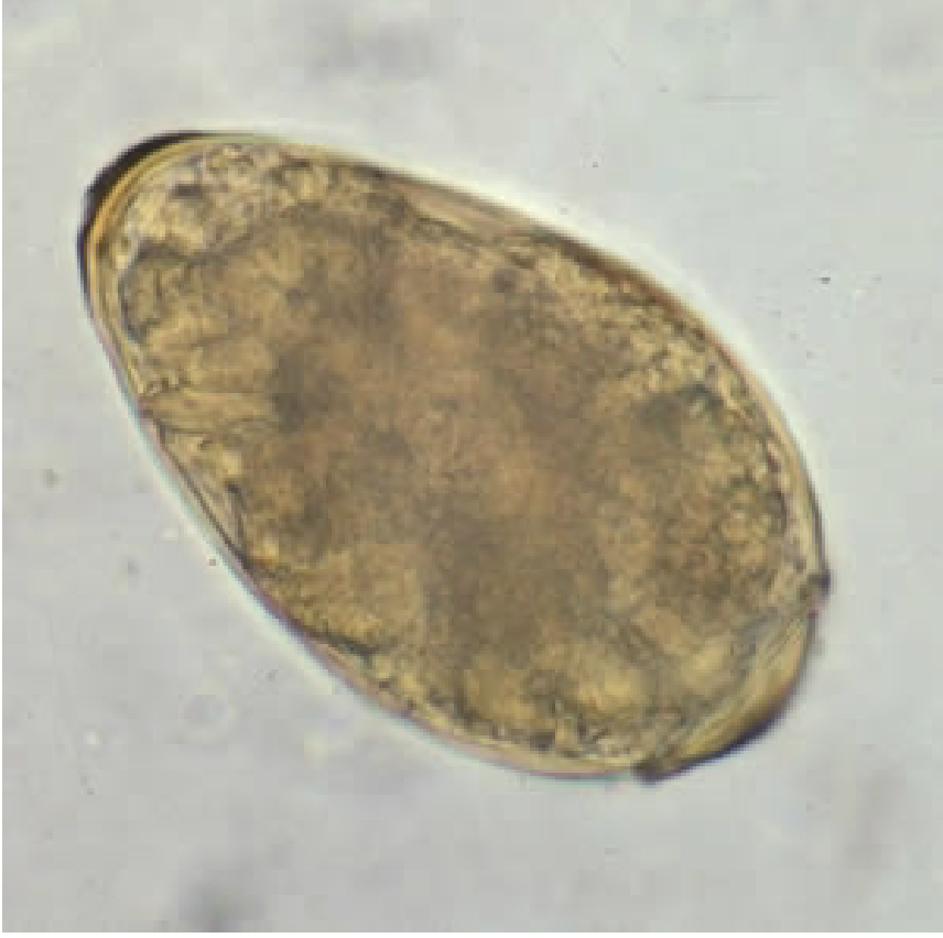 <p>-Eggs are around 100 microns long</p><ul><li><p>May be in stool or sputum</p></li><li><p>Shouldered operculum</p></li><li><p>Thick abopercular end, but no knobs</p></li></ul><p></p>