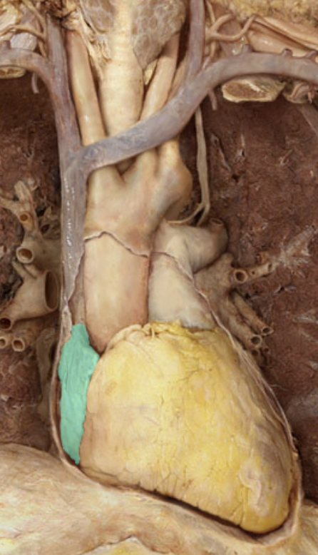 <p>Identify the feature of the heart</p>