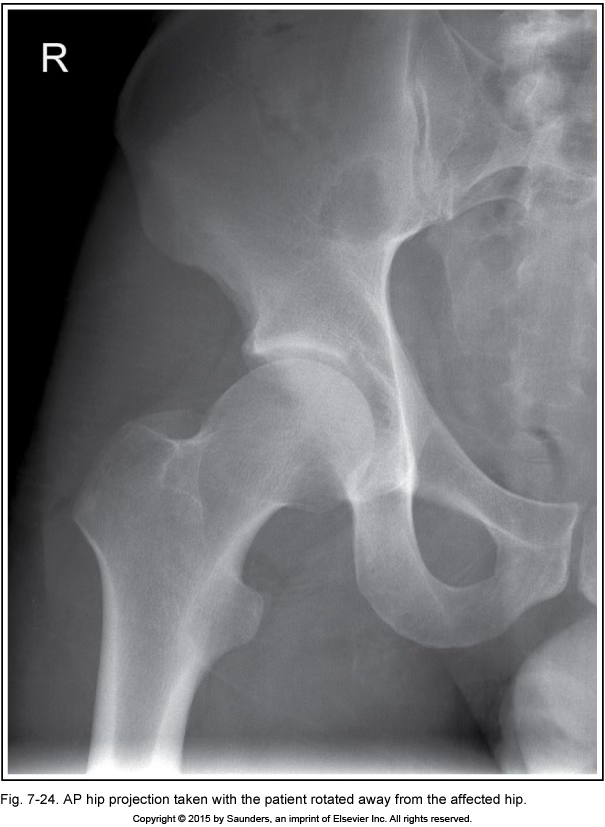 <p>AP hip</p>