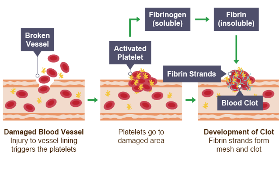 <ul><li><p>Blood vessel is damaged and platelets triggered</p></li><li><p>Converts fibrinogen (soluble) to fibrin (insoluble)</p></li><li><p>Forms a mesh/ net to trap blood components</p></li><li><p>A clot is formed which dries to from a scab</p></li></ul><p></p>