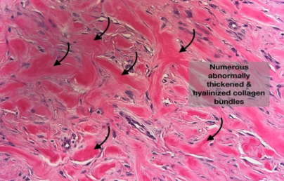 <p>What type of scar is this?</p>