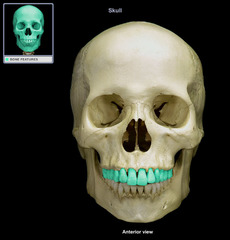 <p>Teeth in the upper part of the jaw, anchored in the maxillary bone.</p>