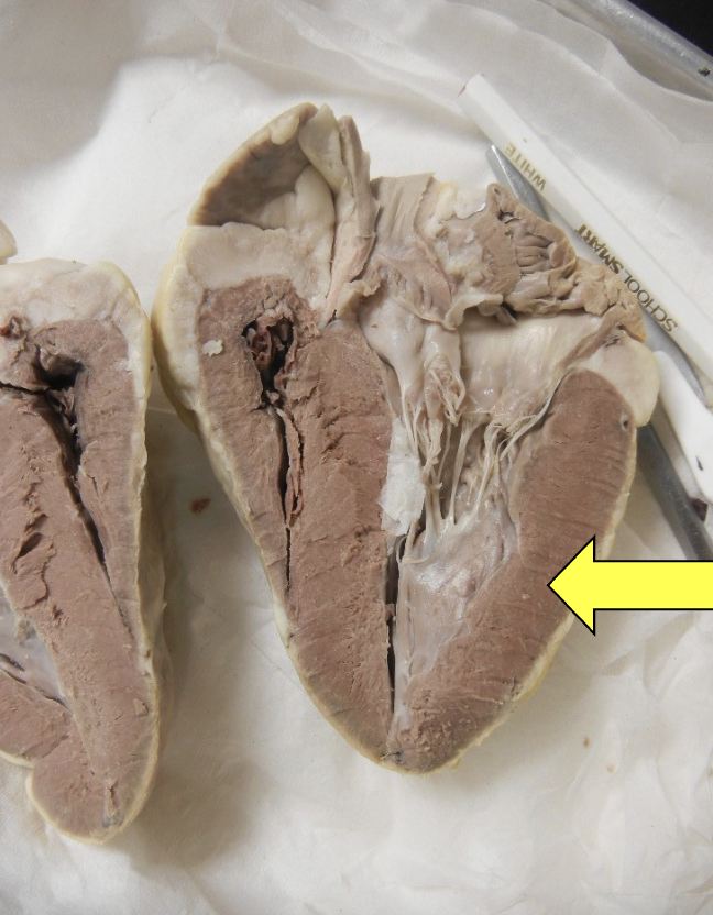 <p>myocardium (cardiac muscle)</p>