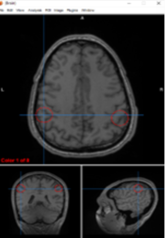 <p>primary somatosensory cortex</p>