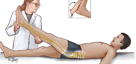 <p>Straight leg raising (Lasegue’s Test) while keeping the knee extended normally produces what?</p>