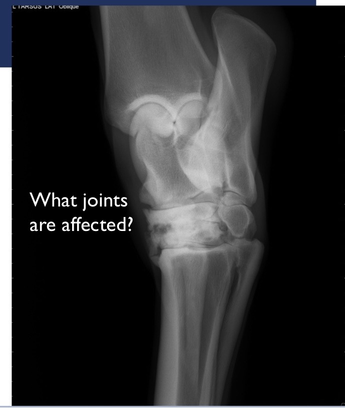 <p>what joints are affected in this radiograph?</p>