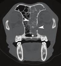 <p>Barnaby presents with a 6-week history of left-sided nasal discharge and epistaxis.</p><p>A lateral skull radiograph is obtained. The image shows a region of mixed opacity in the nasal cavity — some increased soft-tissue opacity and some preserved turbinate architecture. The finding is visible but cannot be attributed to the left or right nasal passage, and its depth within the nasal cavity cannot be assessed.</p><p>A student says: "I can see something abnormal in the nasal region but I cannot tell which side it is on."</p><p>The clinician confirms this observation is correct and asks the student to explain why.</p><p></p><p><strong>Which explanation correctly accounts for why the lateral skull radiograph can detect the nasal opacity change but cannot determine whether it is on the left or right side — and identifies the physical property of radiography responsible?</strong></p><p><span>a. The radiograph cannot lateralize the finding because digital radiography lacks sufficient resolution for the nasal cavity — higher-resolution film radiography would separate left and right nasal structures.</span></p><p><span>b. The radiograph cannot lateralize because nasal disease in dogs is always bilateral — unilateral pathology does not produce detectable opacity changes on lateral skull projections.</span></p><p><span>c. Radiography produces a 2D projection image by passing the X-ray beam through all structures simultaneously along its path — everything in the beam is combined into a single image plane. In the lateral projection the beam passes through both left and right nasal passages, superimposing them. There is no mechanism to separate structures by depth or laterality in a single projection.</span></p><p><span>d. The radiograph cannot lateralize because it uses non-ionizing radiation that scatters unpredictably through the nasal turbinates, preventing accurate spatial attribution of the opacity signal.</span></p>