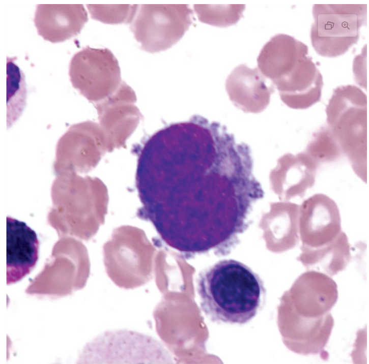 <p>what is a promegakaryocyte?</p>