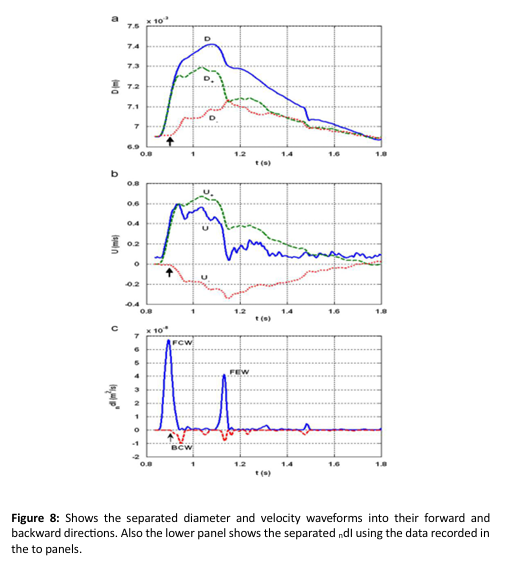<p>ndI±=± 1/4(D/2c)(dD±(D/2c) (dU))²</p>