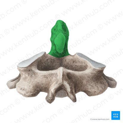 <p>What feature of the Vertebra is this? (The Green)</p>