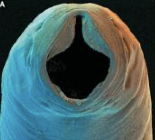 <p>what helminth is this?</p>