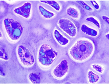 <p>What is cartilage matrix made of?</p>