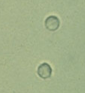 <p>Smaller than WBCs</p><p>Dimorphic RBCs= Problems with filtration membrane</p><p>Ghost cells- RBCs in alkaline urine (Alkaline urine causes cells to lyse)</p><p>Acetic acid- used to distinguish RBCs and Yeast, RBCs will lyse</p>