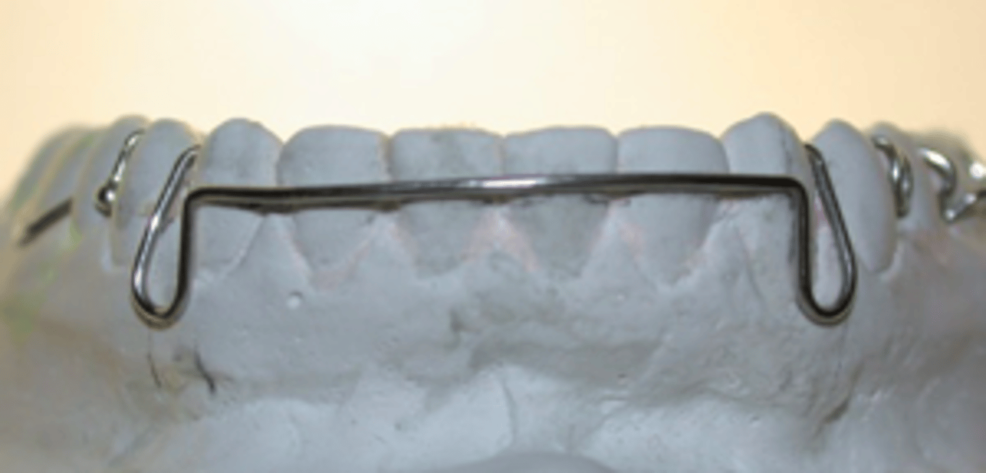 <p>ID the component:</p>