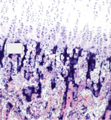 <p>enlarged chondrocytes, metabolically active</p>