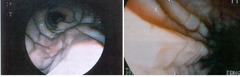 <p>What is the difference in the speculum here?</p>