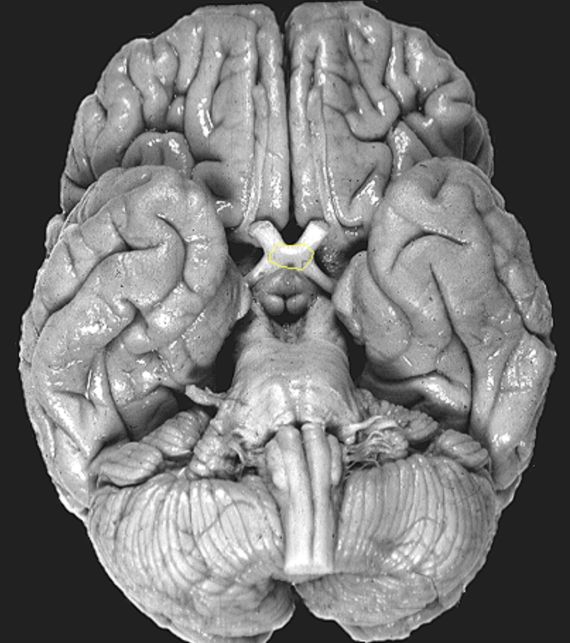 <p>What is the area highlighted called?</p>
