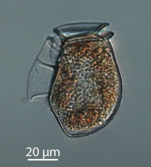 <p> Common dinoflagellate</p><p>• Dinophysis: linked to HABs, Harmful algae blooms</p>