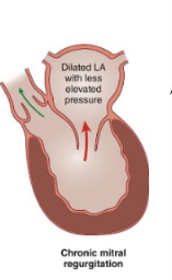 <p>What happens in chronic mitral regurgitation? </p>