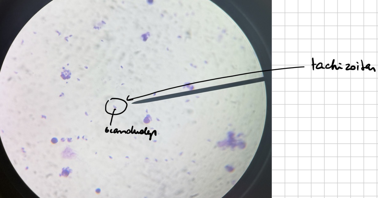 <p>Toksoplazma - toxoplasma gondii</p>