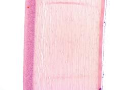 <p>From external to internal, name the four layers of the cornea.</p>