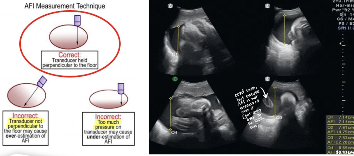 <p>AF measurement method: AFI example</p>