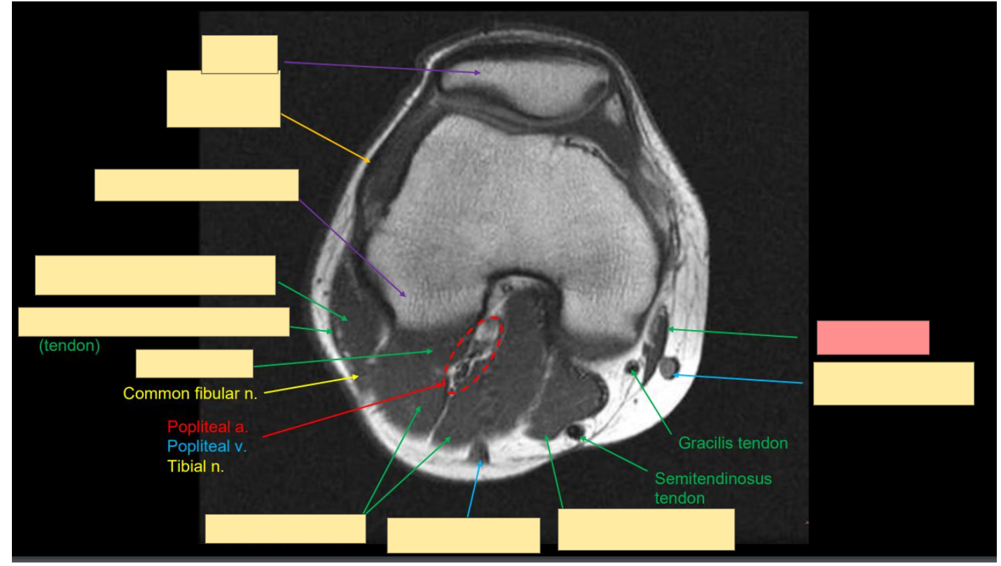 <p>Identify this structure</p>