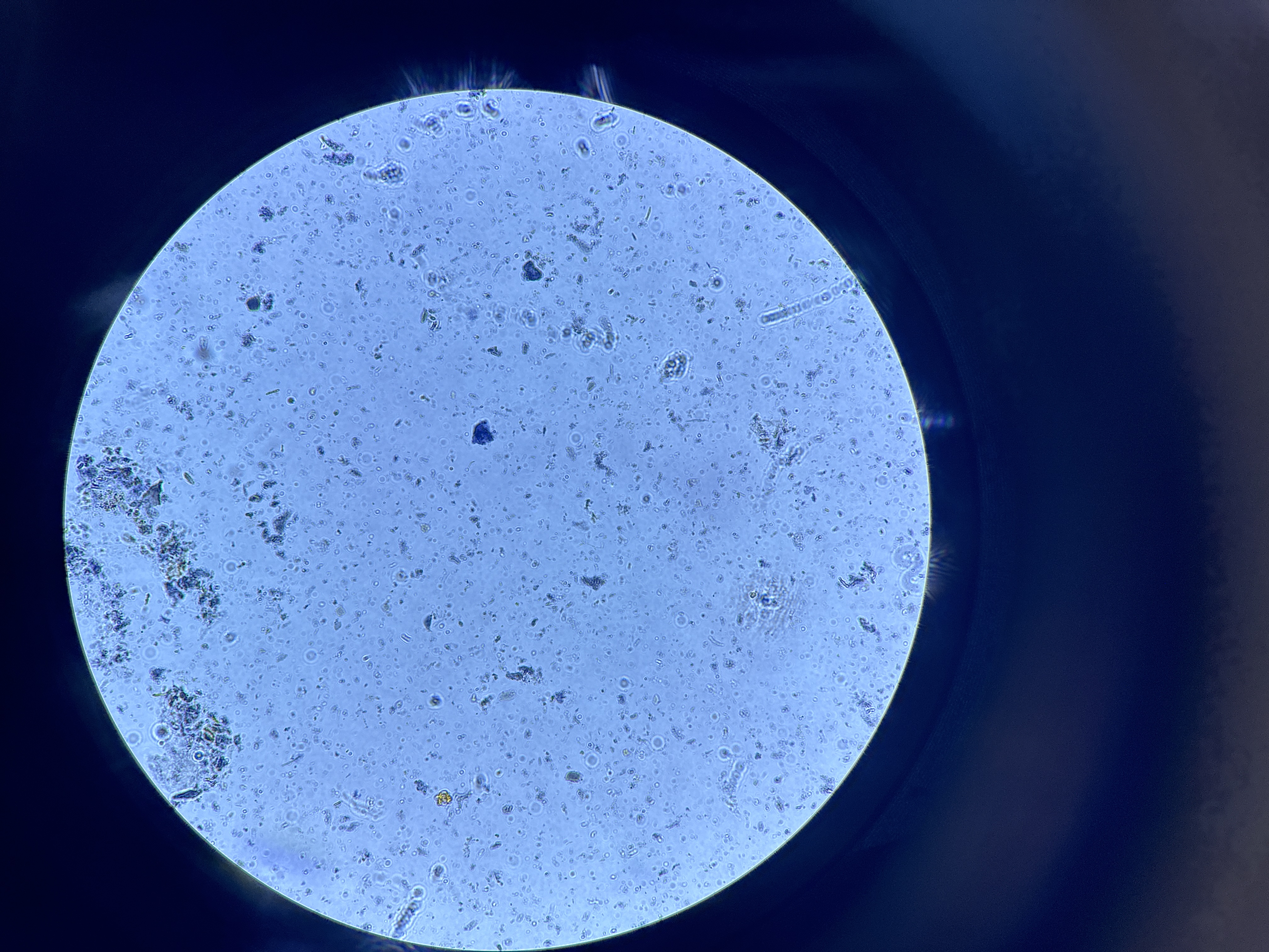 <p>Phylum Diplomonadida</p><p>Genus <em>Giardia</em></p>