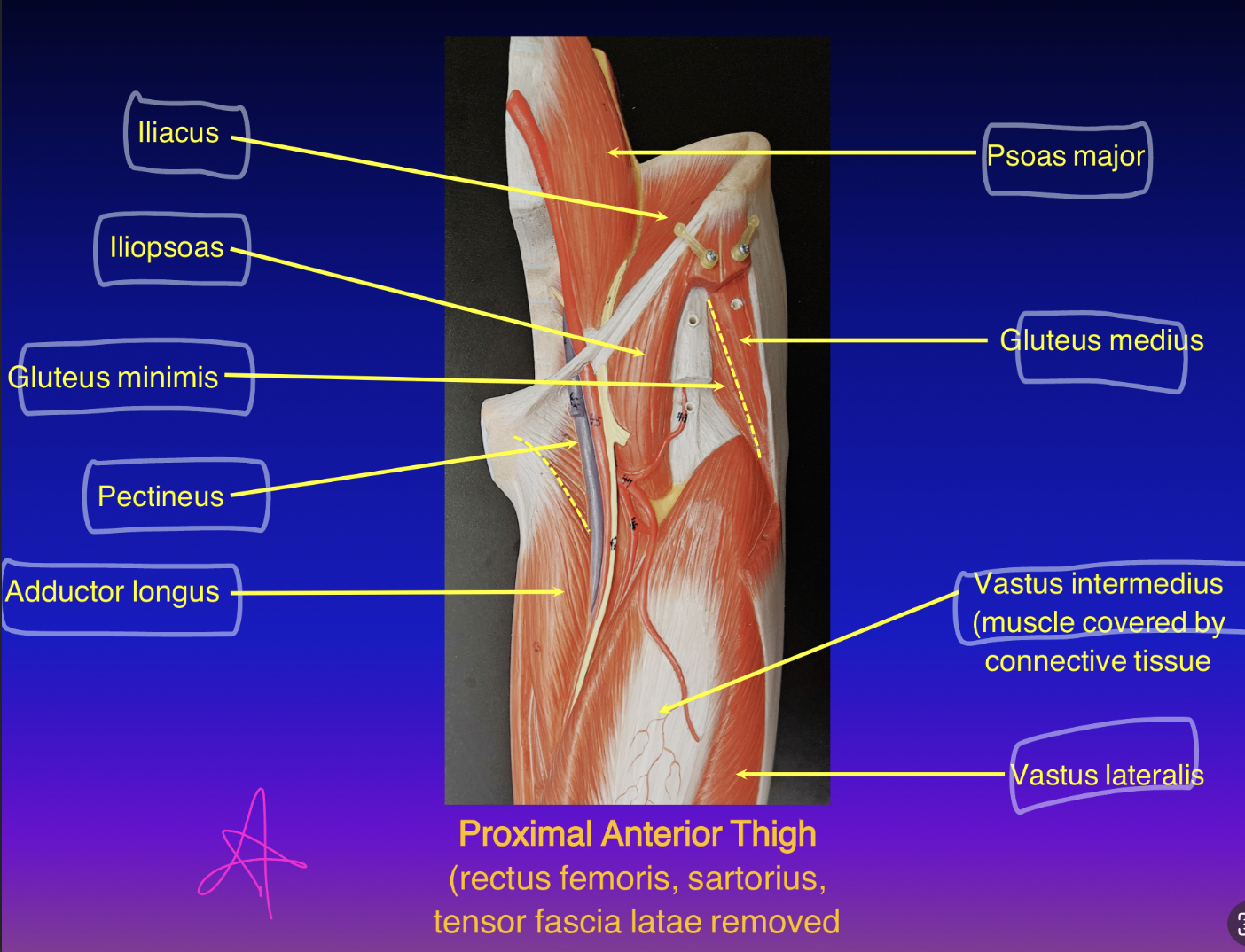 <ol><li><p>origin: <u>anterior and lateral shaft of the femur </u></p></li><li><p>insertion: tibial tuberosity (via patellar tendon)</p></li><li><p>action: extend leg </p></li><li><p>innervation: femoral nerve</p></li></ol><p></p>