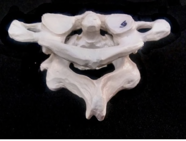 <p>what articulated vertebrae are pictured</p>