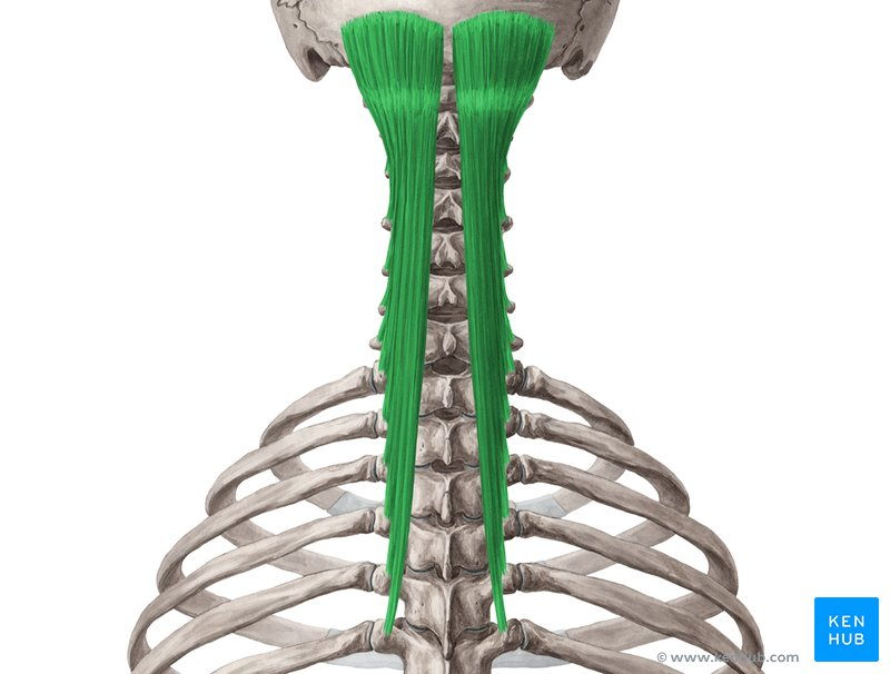 <ul><li><p>origin: transverse processes</p></li><li><p>insertion: spinous processes 4-6 levels higher </p></li><li><p>action: bilaterally extends the spine and unilaterally rotates the spine to the contralateral side </p></li></ul><p></p>