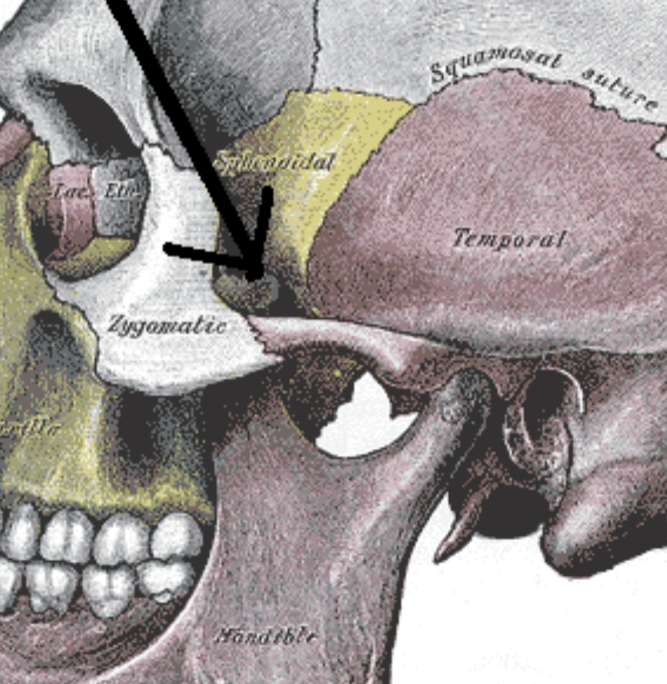 <p>What is this pointing to? What bones are involved?</p>
