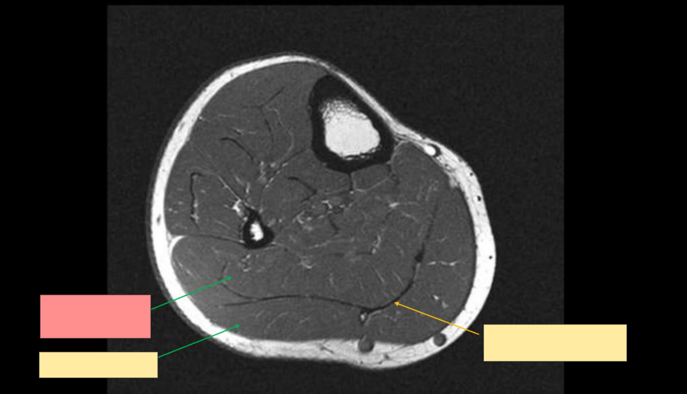 <p>Identify the structure</p>