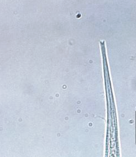 <p>How does human infection occur? </p>