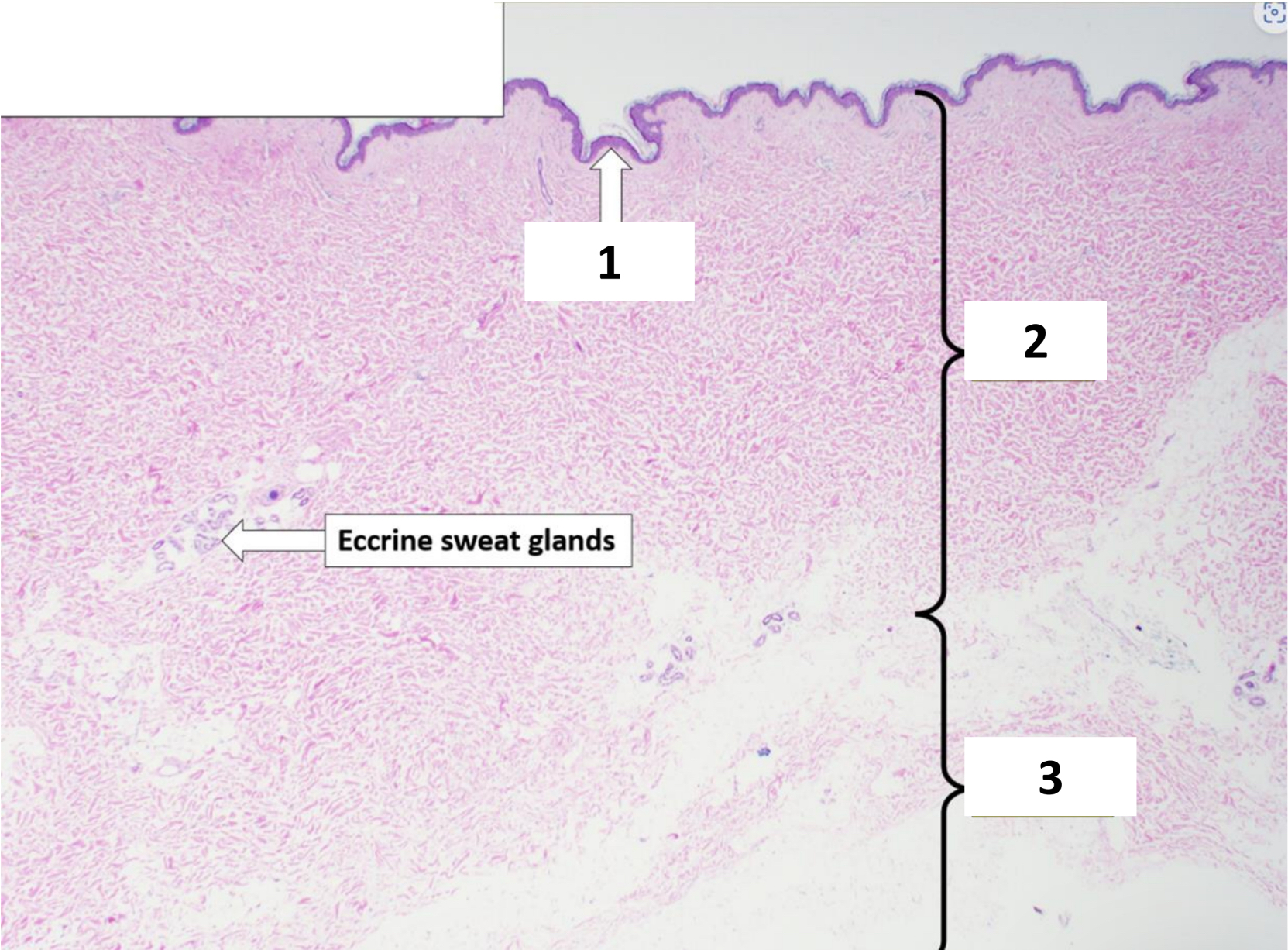 <p>Name the structure indicated by 1.</p>