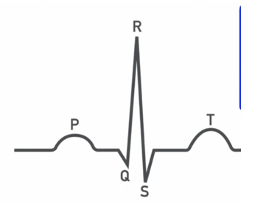 <p>QRS complex shows</p>