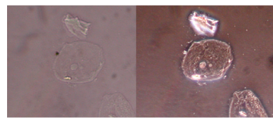 <p><span style="background-color: transparent;">•Scattering produces 2 changes in light: change in brightness and change in phase.</span></p><p><span style="background-color: transparent;">•Human eye is only sensitive to changes in brightness</span></p><p><span style="background-color: transparent;">•Phase contrast microscopes make phase shifts visible as differences in brightness</span></p>