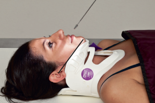 <p>CR is angled towards head</p>