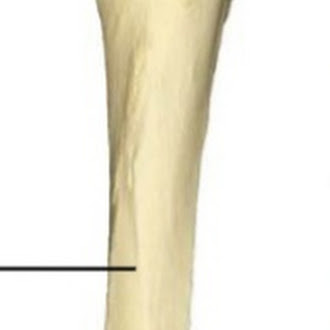 <p>what bone and which way facing</p>