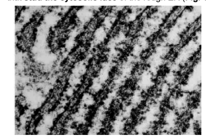 <p>Endoplasmic Reticulum — Rough Endoplasmic Reticulum</p>