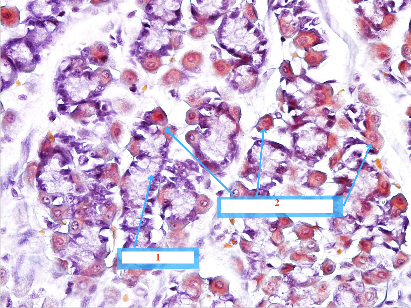 <p>Tế bào gì ?</p>