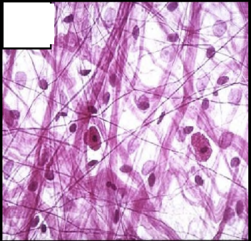 <p>Collagen (pale pink &amp; thick), elastic (thin and dark), and reticular</p>
