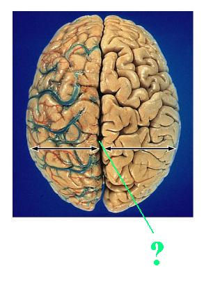 <p>Identfiy the indicated groove of the brain</p>
