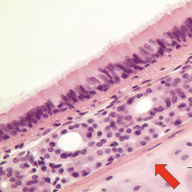 <p>Identify the highlighted structure</p>