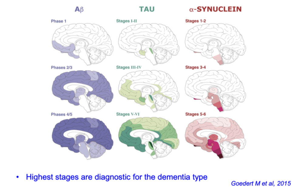 <ul><li><p>Spread <strong>progressively in stages across the brain</strong></p></li><li><p><strong>Aβ:</strong> cortex early</p></li><li><p><strong>Tau:</strong> limbic → cortex</p></li><li><p><strong>α-synuclein:</strong> brainstem → cortex</p></li><li><p><strong>Higher stage = more severe disease / diagnostic pattern</strong></p></li></ul><p></p>