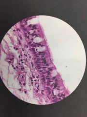 <p>Cells have surface modification of cilia</p><p>Cells not equal in size</p><p>All cells in contact with basement membrane, but not all reach surface</p><p>FOUND LINING TRACHEA AND BRONCHI</p>