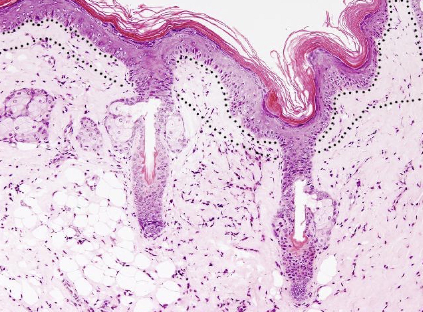 <p>Identify the layer?</p>
