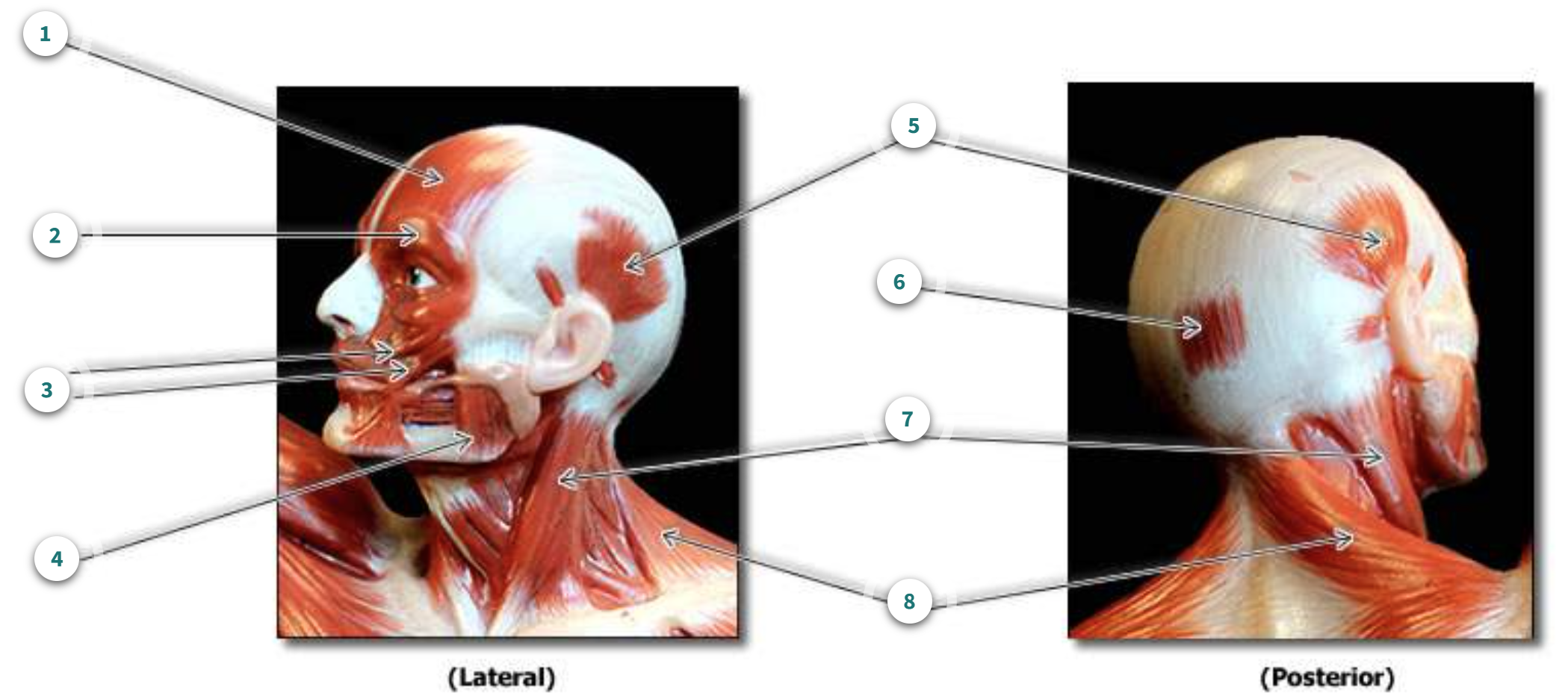 <p>What muscle is number 1?</p>